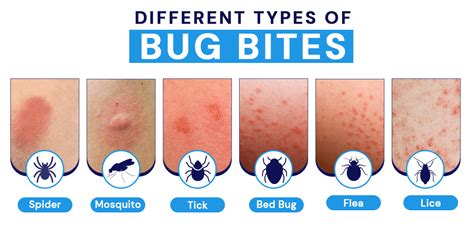 Dreaming of Insect Bites: Causes and How to Alleviate the Itch