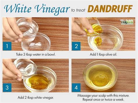 Effective Home Remedies for Dandruff: Tried and Tested