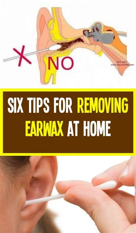 Effective Ways to Safely Remove Excess Earwax at Home