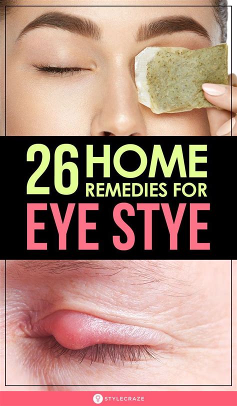 Effective Ways to Treat Styes