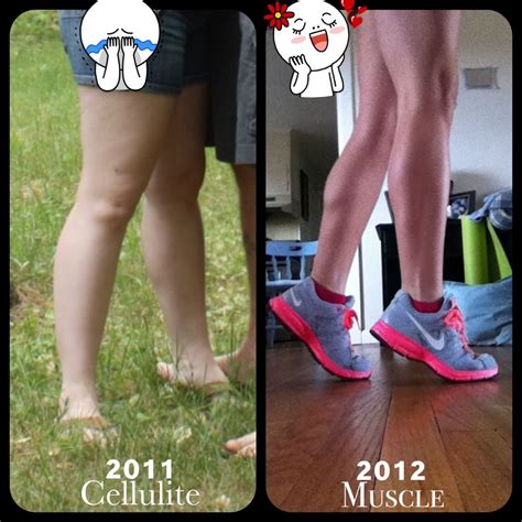 Embracing a Healthy Lifestyle for Long-Term Leg Transformation