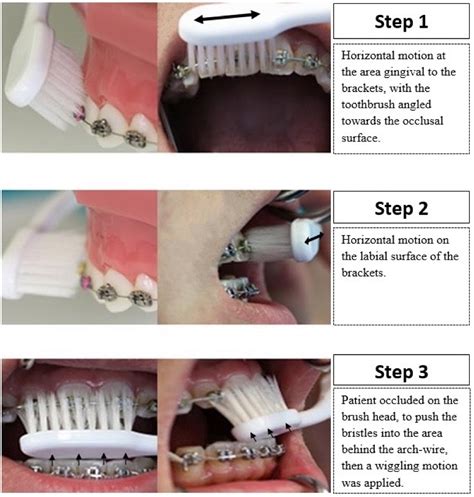 Enhancing the Effectiveness of Brushing