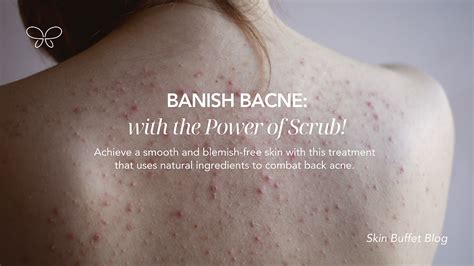 Exfoliation Techniques to Banish Bacne: Scrubs, Brushes, and More