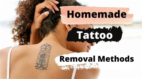 Exploring Alternate Techniques for Tattoo Removal