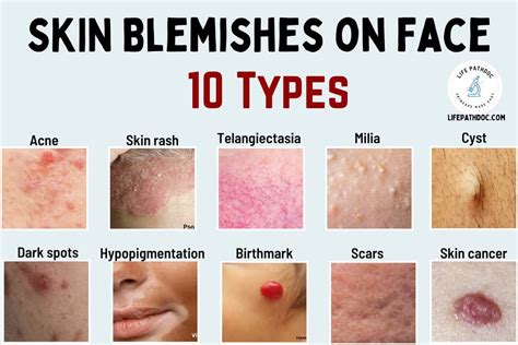 Exploring Cultural and Symbolic Meanings of Blemishes on the Facial Skin