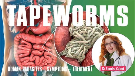 Exploring Medication Options for Getting Rid of Tapeworms