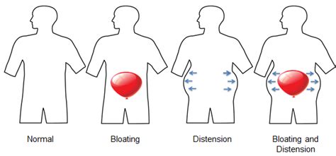 Exploring Possible Physical Explanations for Dream Experiences Related to an Enlarged Abdomen