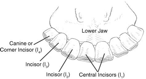 Exploring Variances in Dream Interpretation Theories Regarding Dreams of Damaged Dental Structures