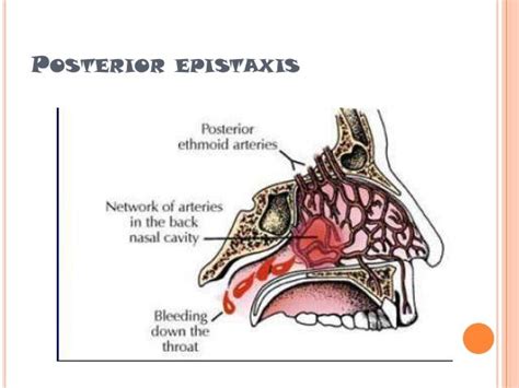 Exploring the Cultural Significance of Dreaming about Epistaxis