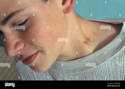 Exploring the Emotional Impact of Fantasizing about Neck Love Bites