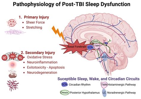 Exploring the Factors Behind Dreaming of Encountering Seizure-Like Episodes