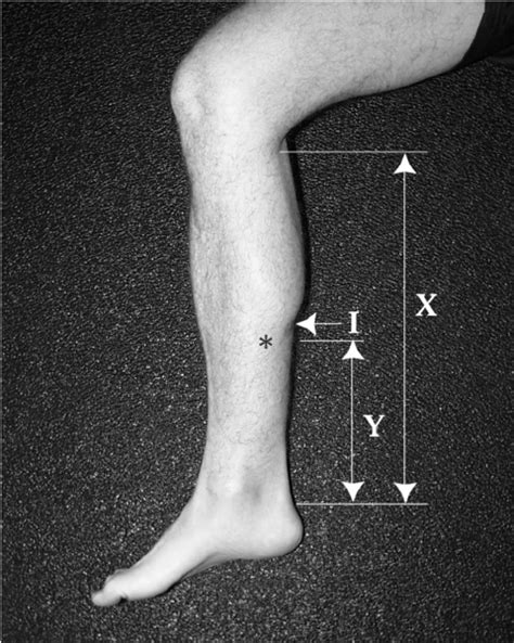 Exploring the Feasibility of Having a Pair of Navel Indentations