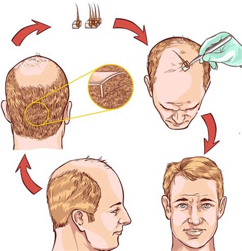 Exploring the Genetic Factors Influencing Hair Aspirations