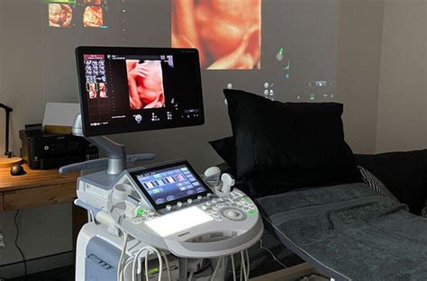 Exploring the Insights of Genetic Imaging: Unveiling the Potential of Ultrasound Scans