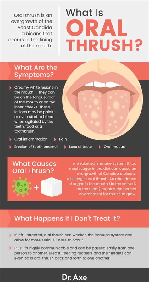 Exploring the Origins and Symbolism of Oral Fungal Infections: Triggers and Meanings