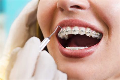 Exploring the Potential Emotional Messages Behind Dreams of Damaged Orthodontic Devices