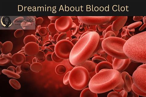 Exploring the Potential Meanings of Dreaming About a Blood Clot in Your Leg