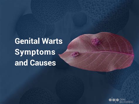 Exploring the Prevalence and Causes of Genital Warts