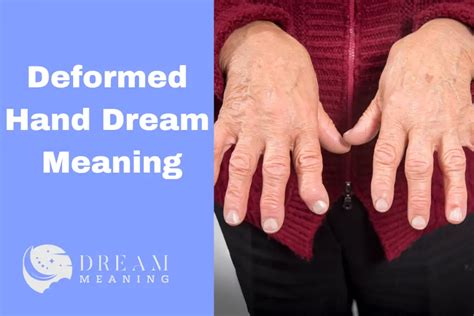 Exploring the Significance of Dreams Involving Injured or Disfigured Hands