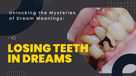 Exploring the Significance of Losing Teeth in Dreamscapes: Analyzing the Symbolic Essence of Loss