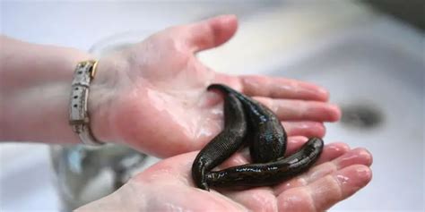 Exploring the Symbolic Significance of Leeches on Hands