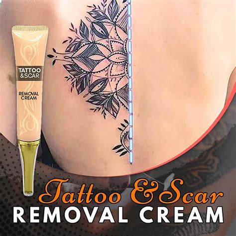 Exploring the claims and realities of tattoo removal creams