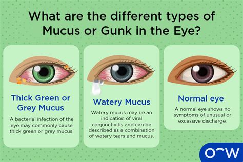 Eye Mucus: What Causes It?