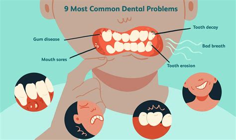 Factors that Contribute to Dental Issues in Dreams