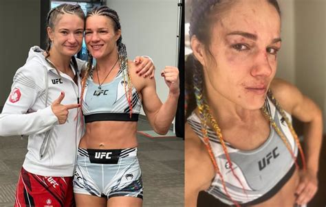 Felice Herrig's Early Life and Background