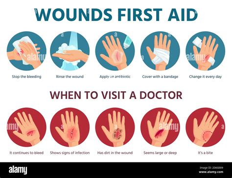 First Aid Measures: Immediate Care for Infected Fingers