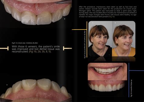 From Childhood Fantasies to Adult Dreams: The Evolution of Imagining Dental Scenarios