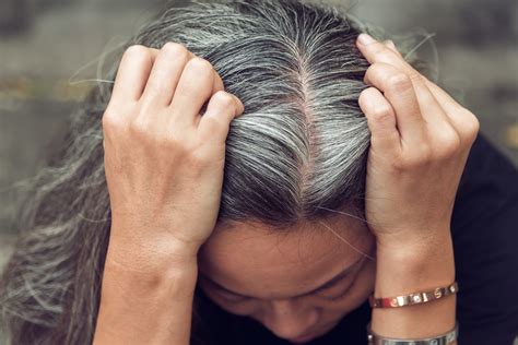 Gray Hair as a Sign of Stress and Anxiety