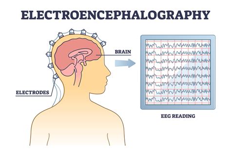 Harnessing the Potential of Thought: The Science Unveiled by Electroencephalography