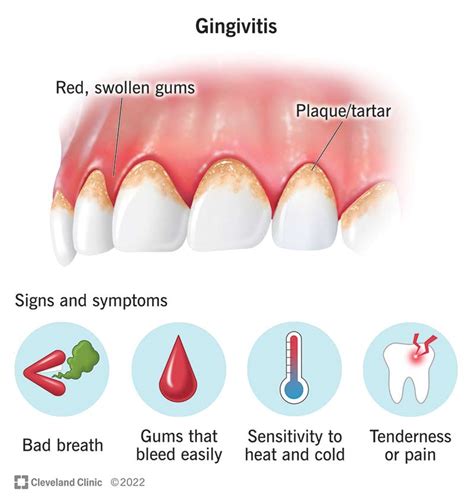 Identifying the Symptoms of Gum Inflammation