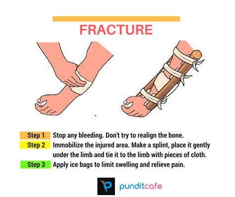 Immediate First Aid for a Possible Fracture in the Shin Bone