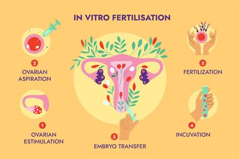 In Vitro Fertilization: Achieving the Realization of Parental Aspirations