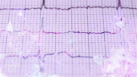 Interpreting a Heart Attack Dream: An Eye-Opener to Prioritize Personal Well-being?