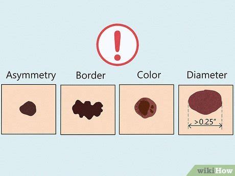 Interpreting the Importance of Size: Decoding the Significance of Large Moles in Dreams