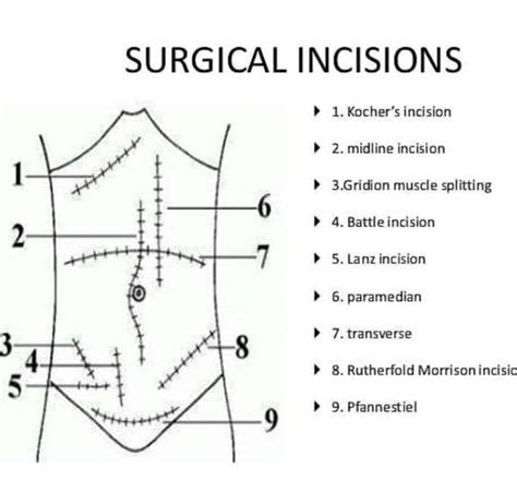 Is there cause for worry if you frequently experience dreams related to incisions in medical procedures?