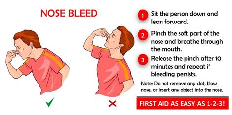 Knowing When to Seek Medical Assistance for a Nosal Hemorrhage