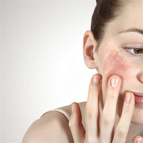 Knowing When to Seek Professional Assistance for Skin Imperfections