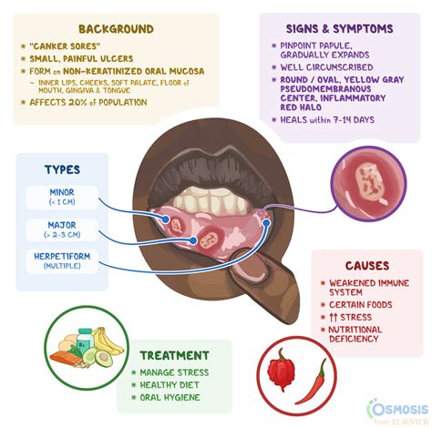 Long-term Management of Chronic Mouth Ulcers