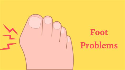 Maintaining Healthy Feet: Preventing Common Problems