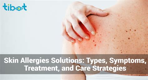 Managing Skin Allergies: Exploring Treatments and Strategies for Prevention