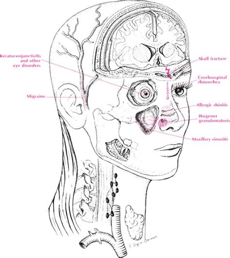 Medical Conditions Associated with Hemorrhagic Nasal Discharge