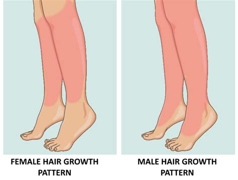 Medical Conditions and Leg Hair Growth