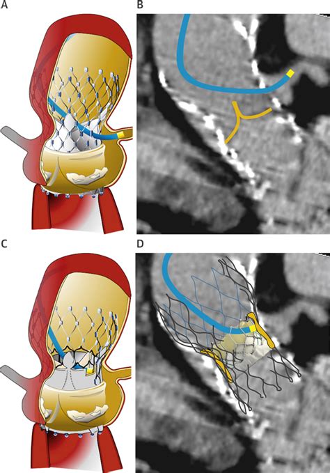 Meet Coral Aorta: A Glimpse into Her Life