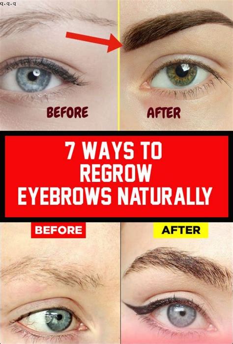 Methods to Treat the Loss of Eyebrows: Natural and Medical Solutions