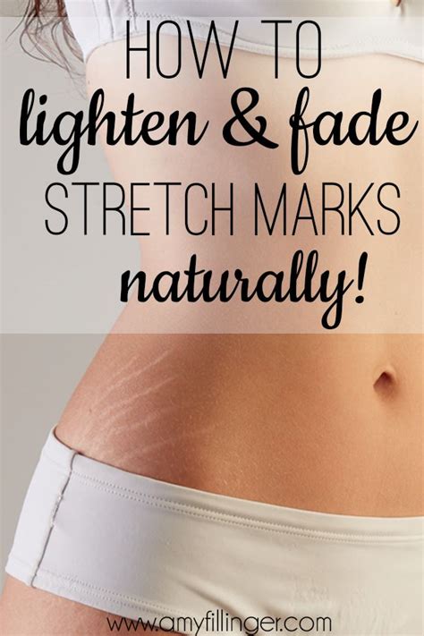 Natural Remedies: Can They Truly Aid in Fading Stretch Marks?