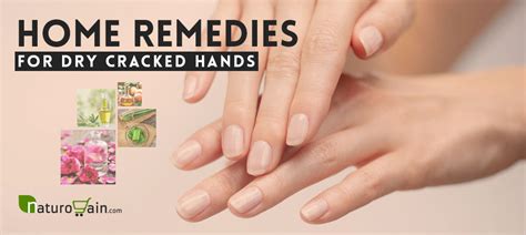 Natural Remedies for Dry Hands: Home-based Solutions